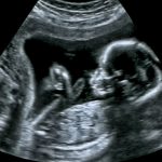 Kentucky judge dismisses life at conception as a ‘Christian and Catholic belief’